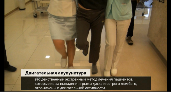 Двигательная акупунктура