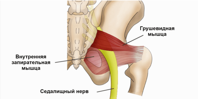 Синдром грушевидной мышцы (Синдром ложной грыжи межпозвонкового диска)-3 1. Грушевидная мышца-это мышца берущая начало от крестца и крепляется к бедренной кости, между которой проходит седалищный нерв.